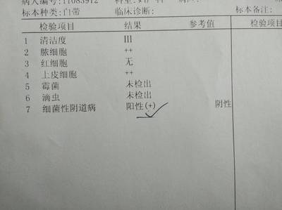 白带常规化验多少钱