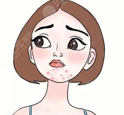 痘痘结痂可以珍珠粉