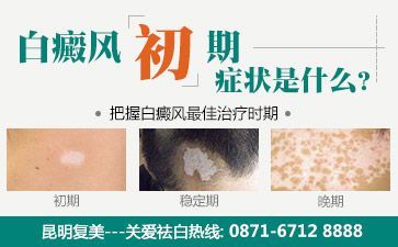 白癜风该怎么治疗好