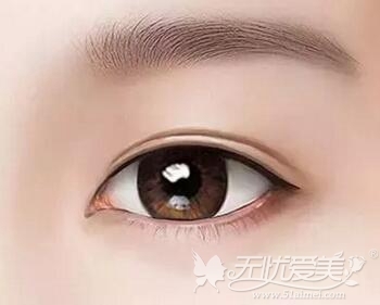 东莞双眼皮询华美