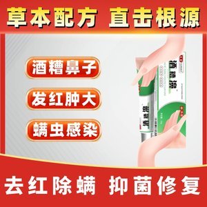 鼻子上痘痘用什么药膏